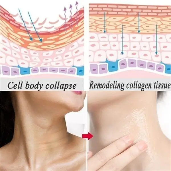 Skin Cream Neck Firming Cream Anti Aging Moisturizer for Neck Double Chin Reducer Skin Tightening Cream