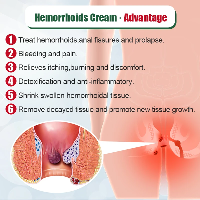 Relieve Pain Hemorrhoids Cream Anti Swelling Formula Anal Tear Bleeding Hemorrhoids Pain Relief Cream Repair Soft Tissue G003 pain relief cream knee pain relief cream