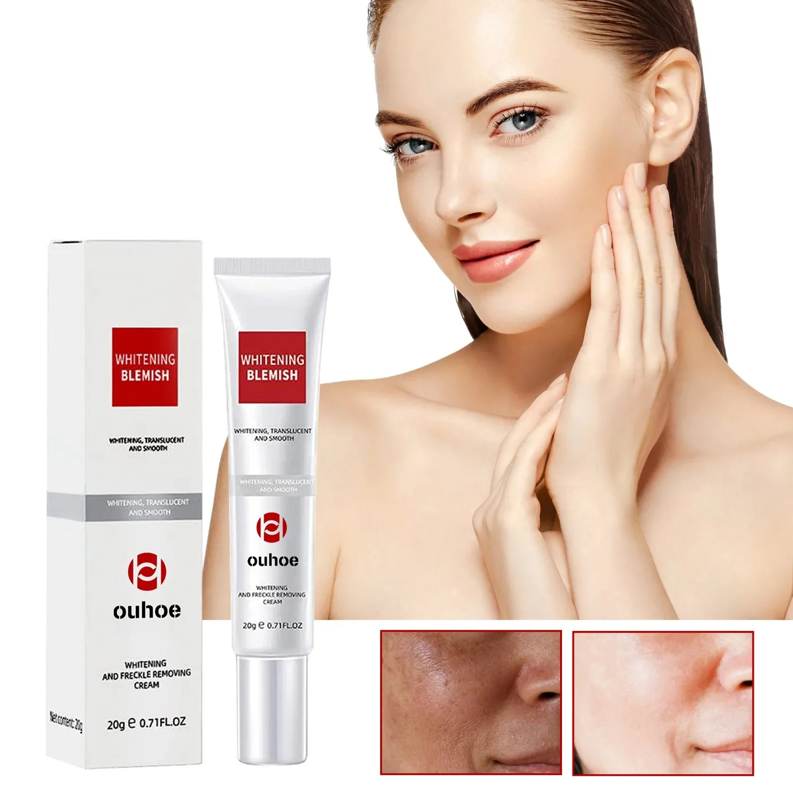 Creme corretor de manchas escuras, creme para remoção de sardas e manchas, reduz manchas de idade, melhora o embotamento, ilumina e nutre cuidados com a pele_voghion.com