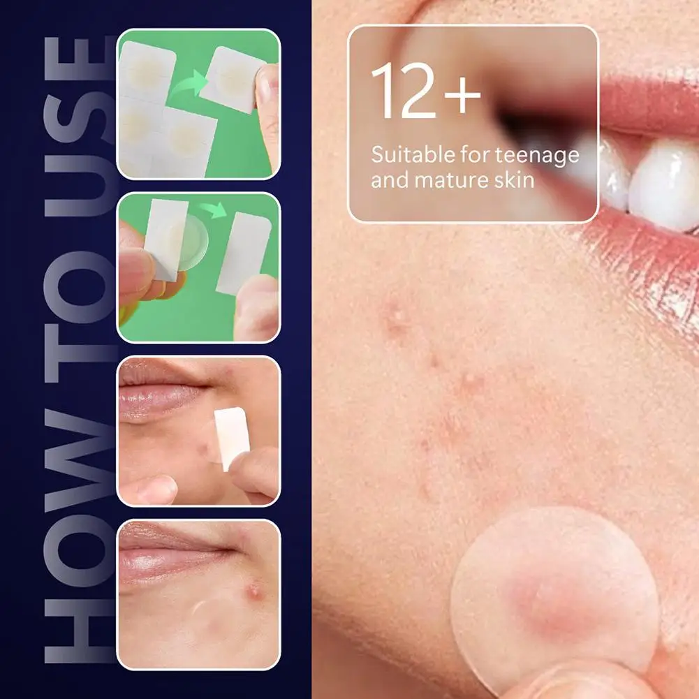 Hydrocolloid Round Pimple Patch Ultra-thin Invisible Micro Needle Acne Patches 8 Hours Effective Facial Care Acne Cover Sticker