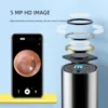 Dr.isla HD Smart Visual Ear Sticks Endoscope High Precision Earpick Camera Otoscope Health Care Ear Cleaner Ear Wax Remover 4