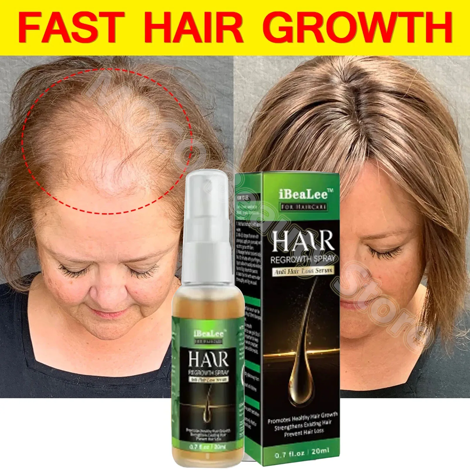 Ginger Hair Growth Products Fast Growing Essential Oil Biotin Prevent Loss Serum Spray Scalp Treatment Beauty Care For Men Women