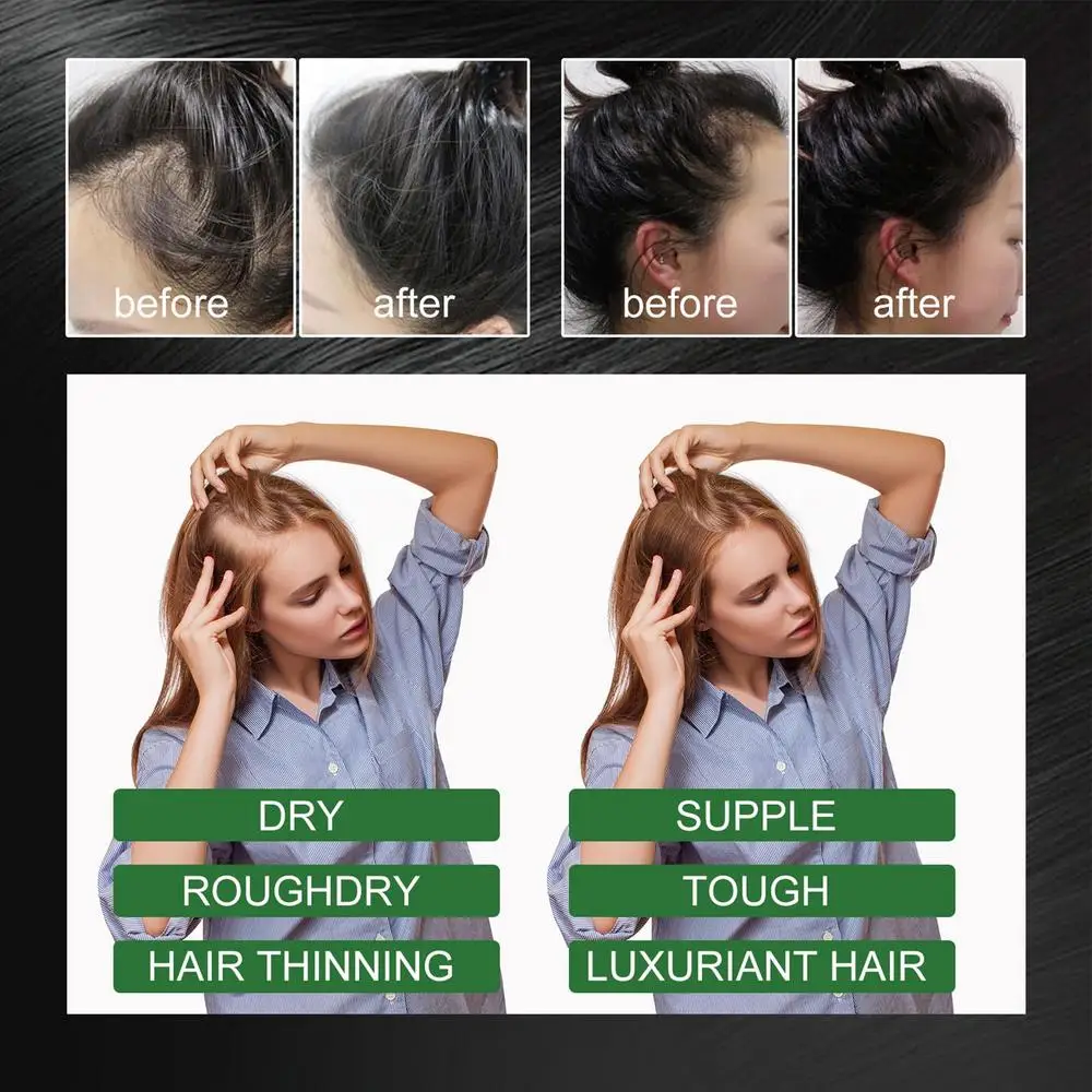 Rosemary Hair Essential Oil Dry Hair Damage Hair Care 60ml Deep Conditioning Anti Hair Loss Essence Serum Repair Hair Scalp Care_voghion.com