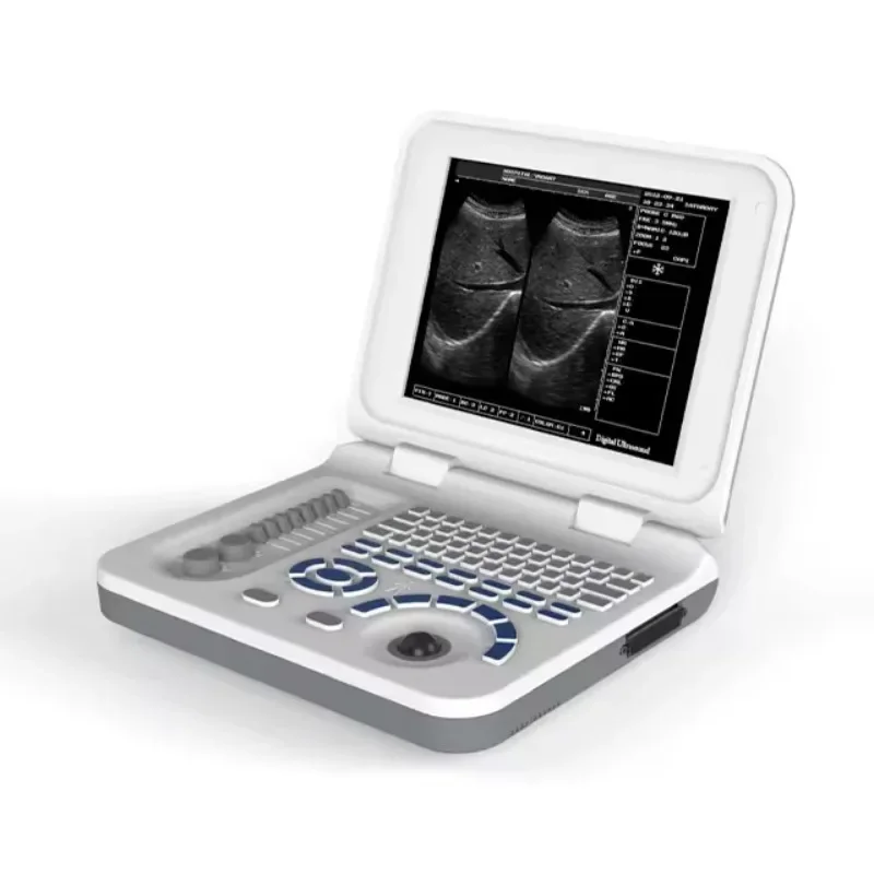 

Sale LED Laptop 10.4 inch Screen Portable Ultrasound Scanner Machine