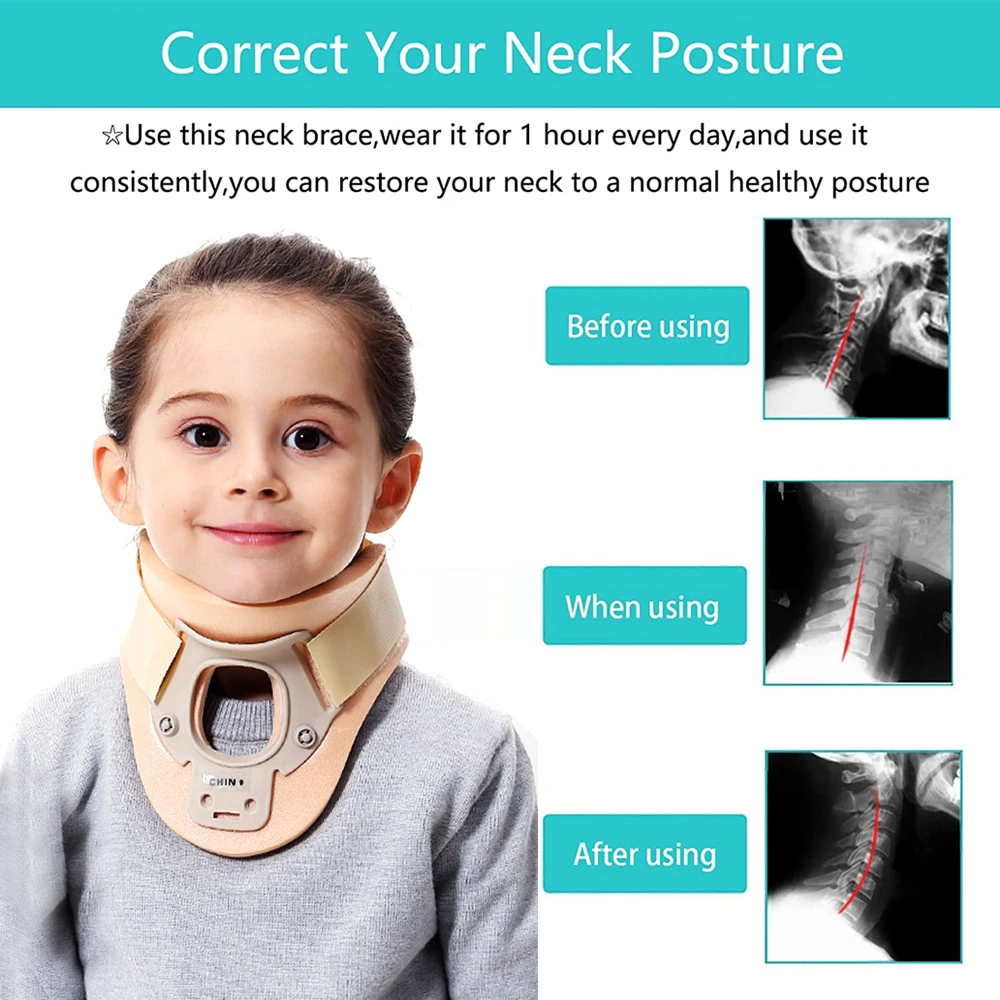 TIKE Medical Baby Child Kids Neck Brace Foam Lightweight Soft Cervical Collar, Support Neck Traction Device Neck and Head Braces 3
