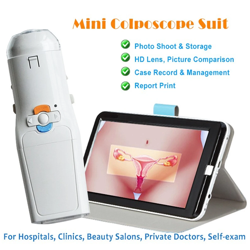 Mini Colposcope with Digital Video for Accurate Link PC Monitoring Health Monitors Accesorios Medicos Selectable Add Pad