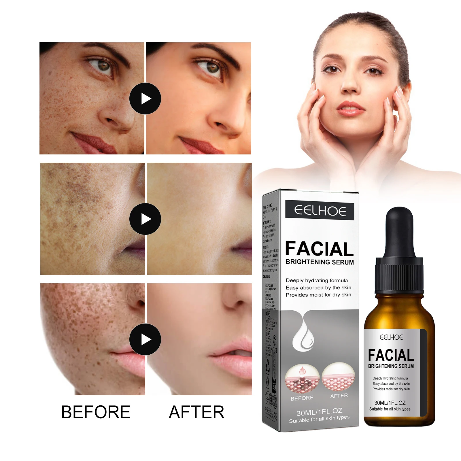 Dark Spots Remover Whitening Serum Face Freckle Melanin Correcting Anti Pigmentation Brighten Skin Beauty Care Products facial serum,facial essence,whitening serum,retinol face serum,salicylic acid facial serum