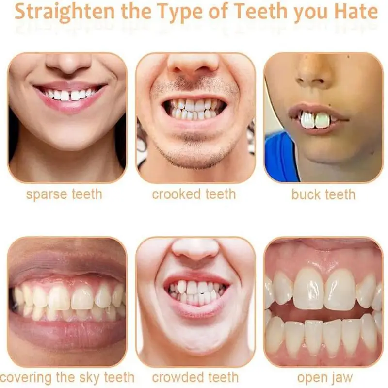 Silicone Denture Kit Denture Silicone Liners Kit Fake Teeth Braces Comfortable Teeth Orthodontic for Women Men denture kit