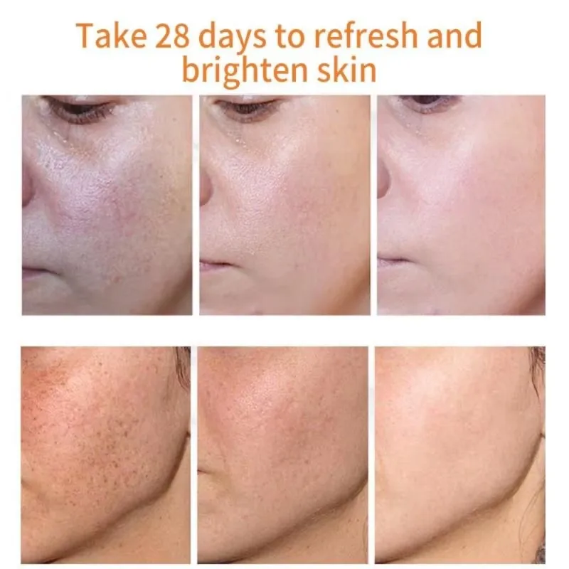 Dark Spots Remover Whitening Facial Serum Face Freckle Melanin Correcting Anti Pigmentation Brighten Skin Care