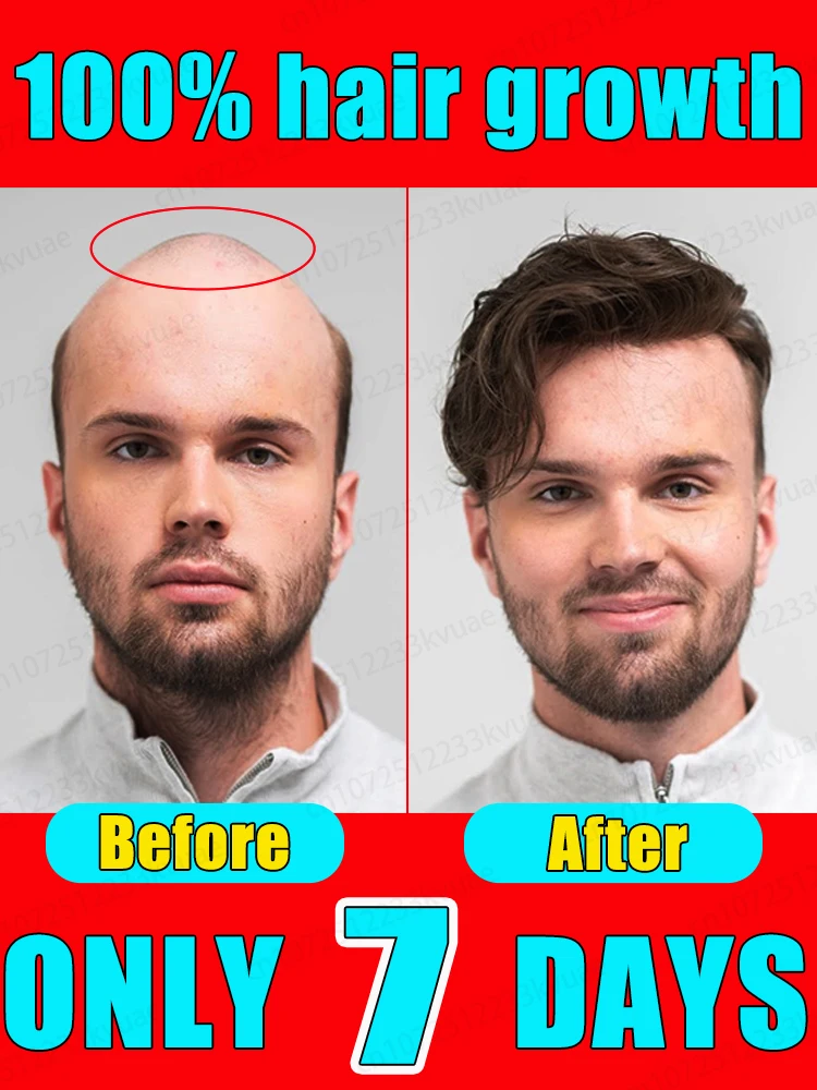 Grow back lost hair stop baldness loss in 7 days