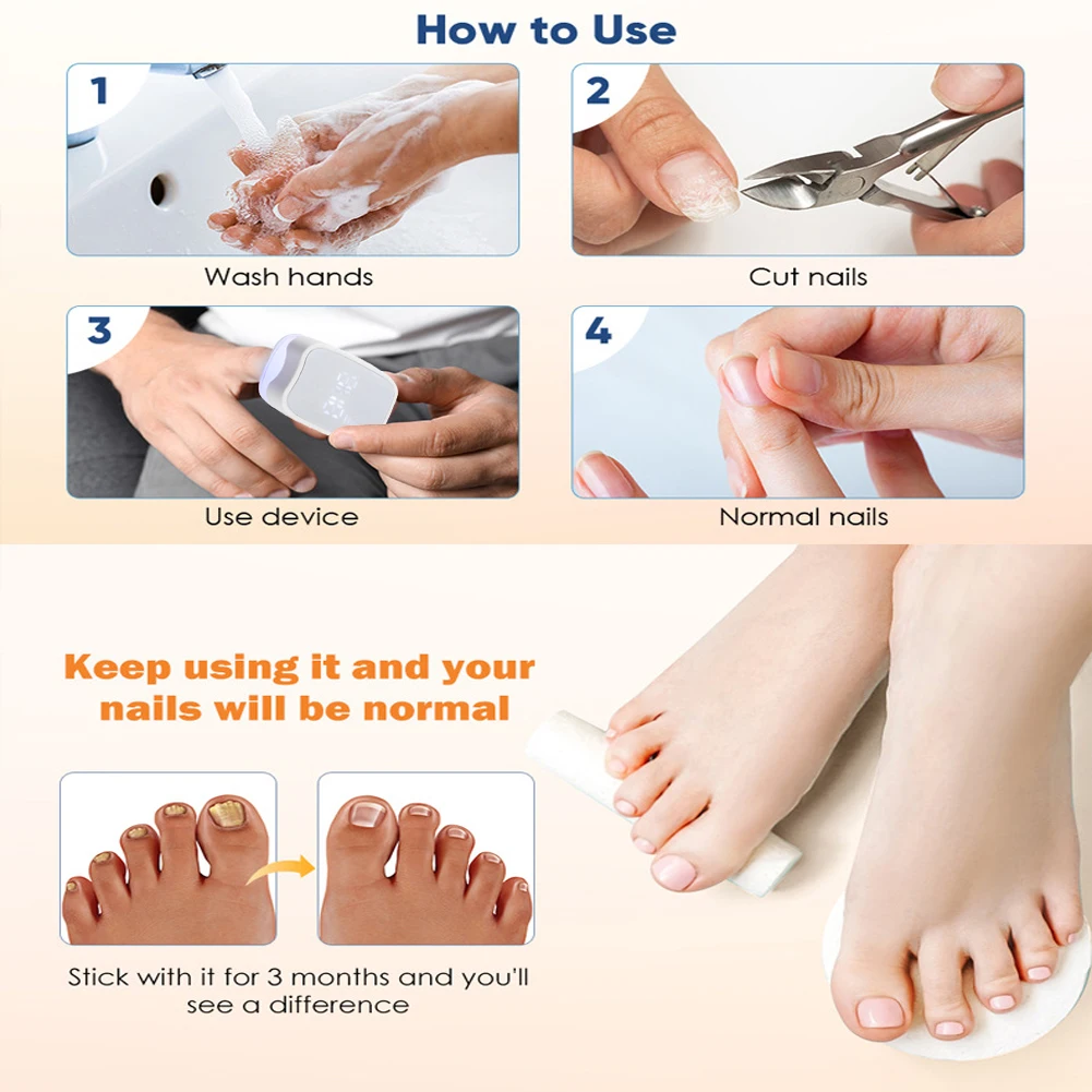 Repair Nail Fungus Laser Treatment Device Nail Fungal Essential Oil Toenail Fingernail Onychomycosis Serum Toe Cure Effectively nail fungus remover laser therapy pen
