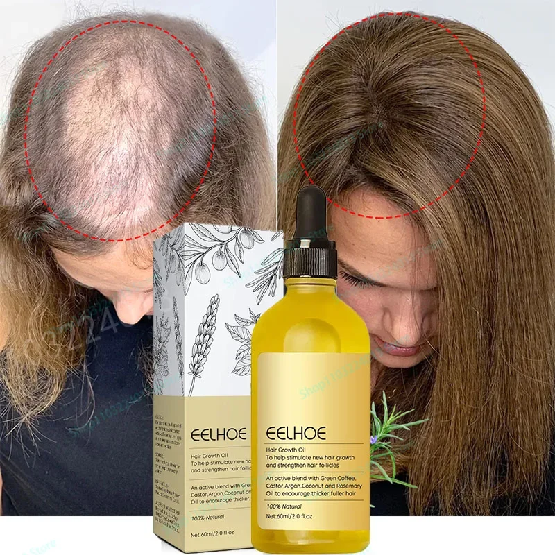 Strong Effect Hair Growth Products Ginger Essential Oil 2 Week Treat Hair Loss Scalp Repair Nourish Hair Roots Regrowth