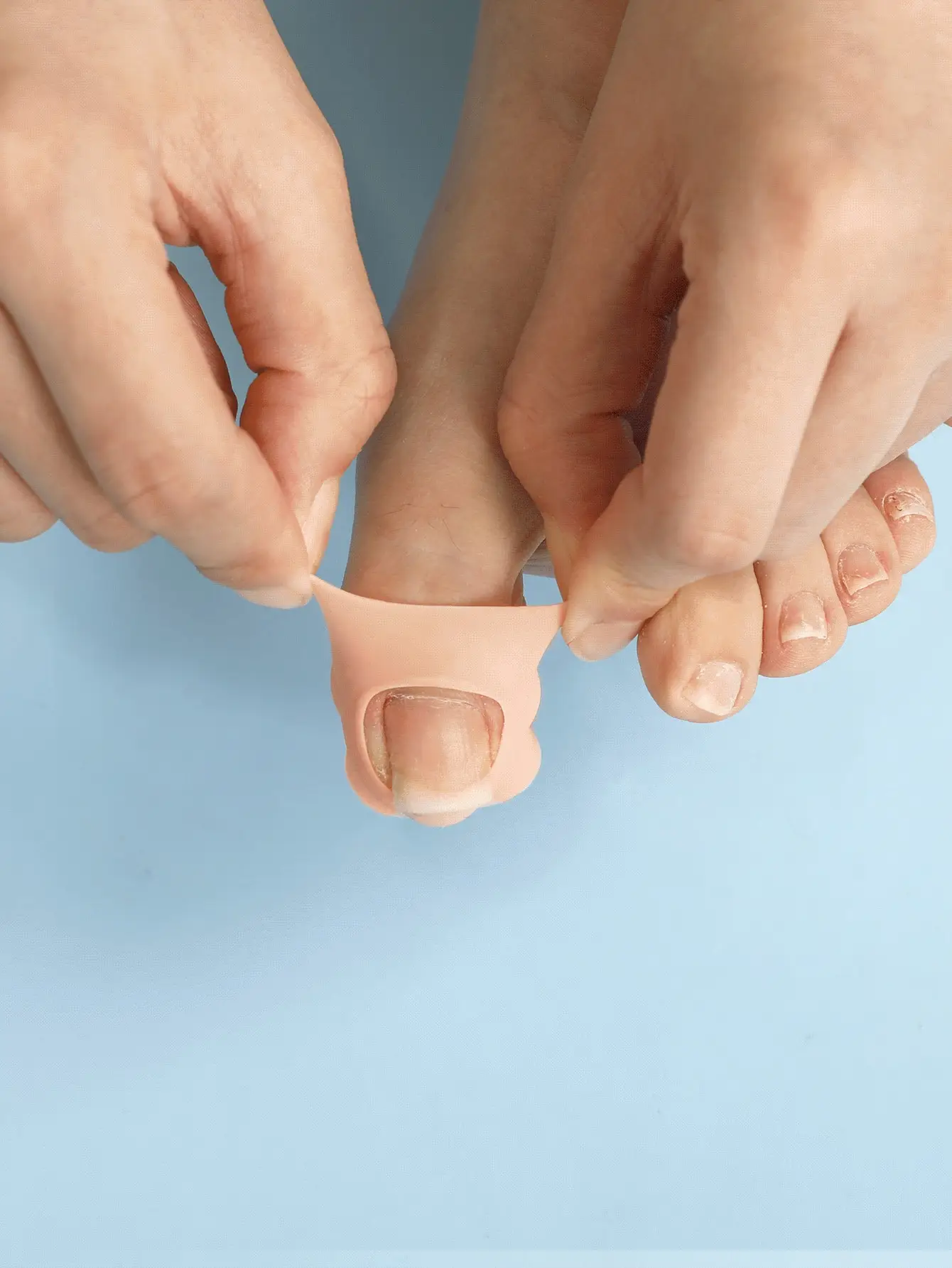 Silicone Ingrown Toenail Protector Covers for Foot Care