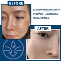 Dark Spot Remover Kojic Acid Serum Sun Spot Freckles Melasma Brown Spot Whitening Moisturizing Facial Glowing Skin Care Beauty 4