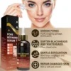 Pore Shrink Face Serum Remove Blackheads Acne Acidity Oil Control Repair Essence Moisturizing Nourish Pores Firming Facial Care 4