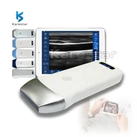 Competitive Price Handheld Pocket Ultrasound Portable Wireless Ultrasound Scanner Working With IOS/Android/Windows 1