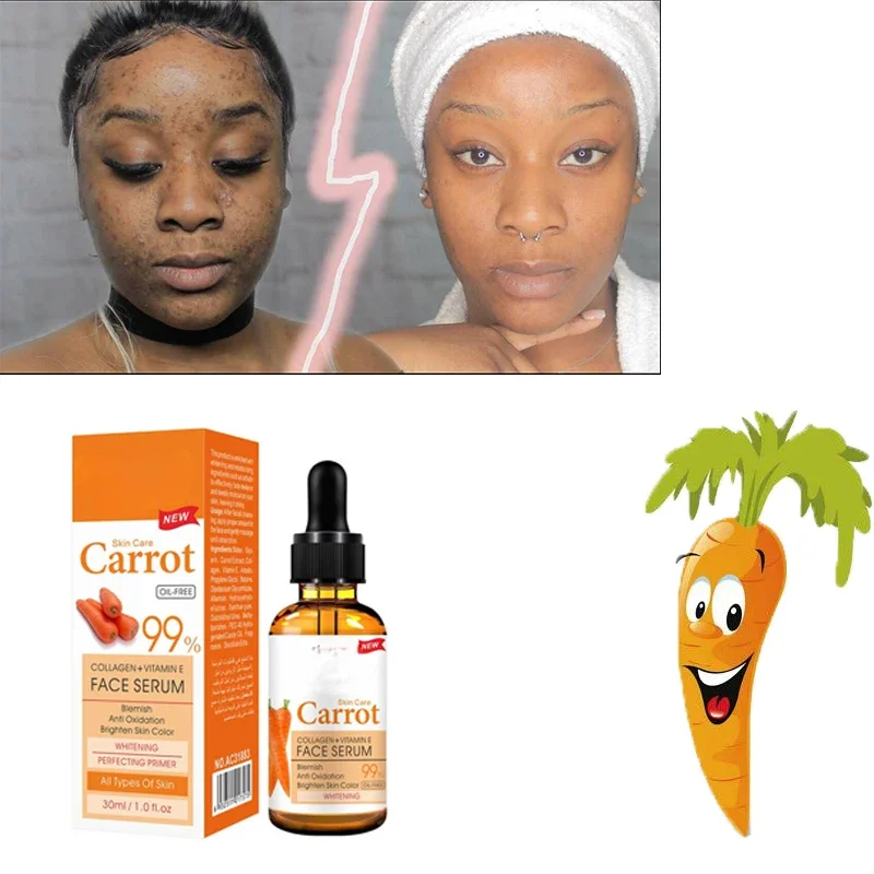 Face Lightening Beauty Collagen+Vitamin E Carrot Face Brightening Serum- 99% Oil  Whitening Essential Oil Brightening Spotless 5d gluta carrot extract serum for face hydrate brightening remove blemishes restore skin radiance female daily skincare