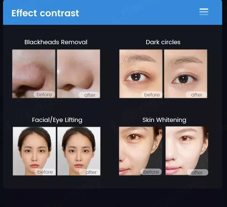 9 in 1 다기능 하이드로 페이셜 박피 기계, 페이셜 클리닝 피부 재생 미백 살롱 미용 장치