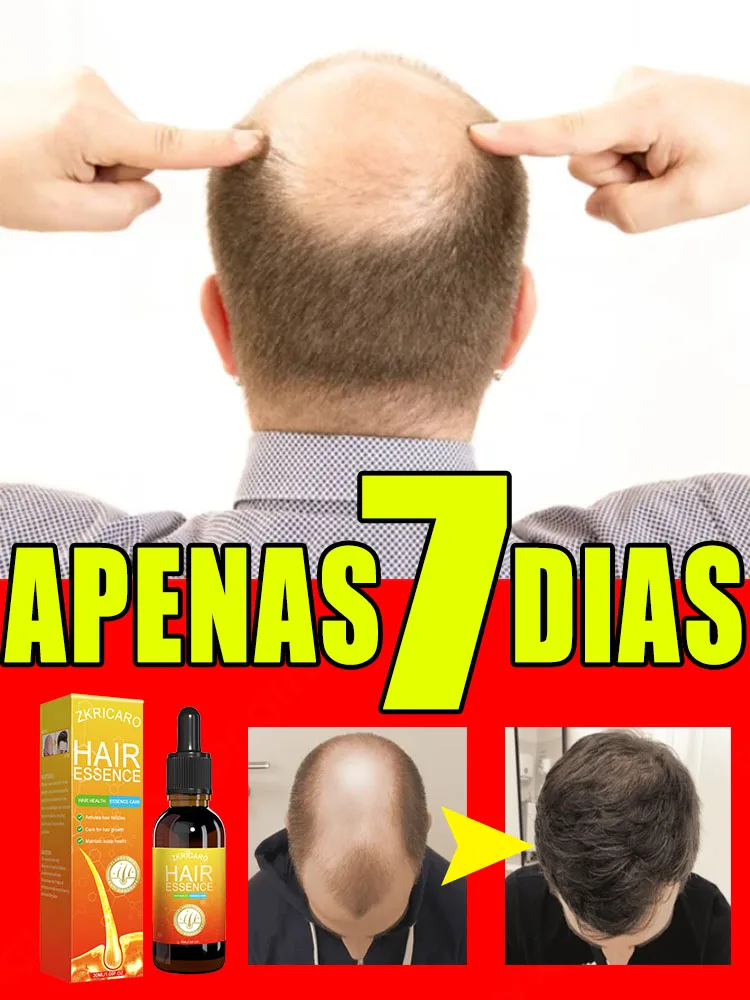 leo-essencial-anti-alopecia-para-o-crescimento-r-pido-do-cabelo-soro