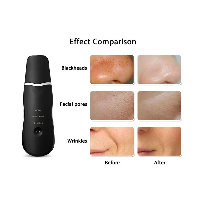 New Electric Ultrasonic Skin Scrubber Vibration Face Spatula Peeling Blackhead Remover Facial Lifting Cleansing Skin Care Device