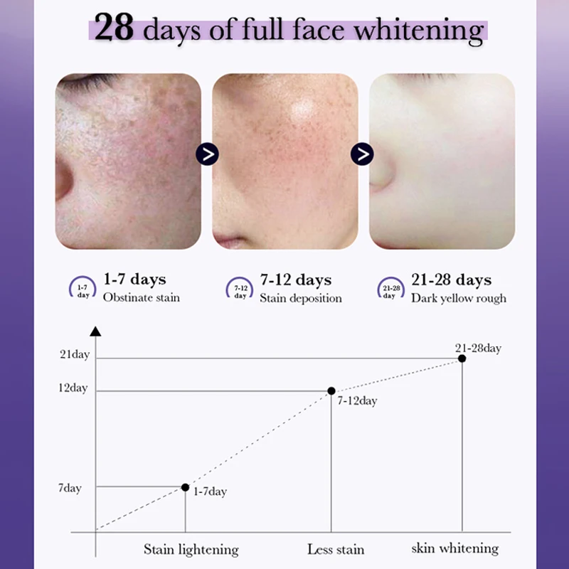 Nicotinamide Dark Spots Removal Whitening Cream Brighten Freckle Melanin Melasma Blemishes Pigmentation Face Skin Care Ointment