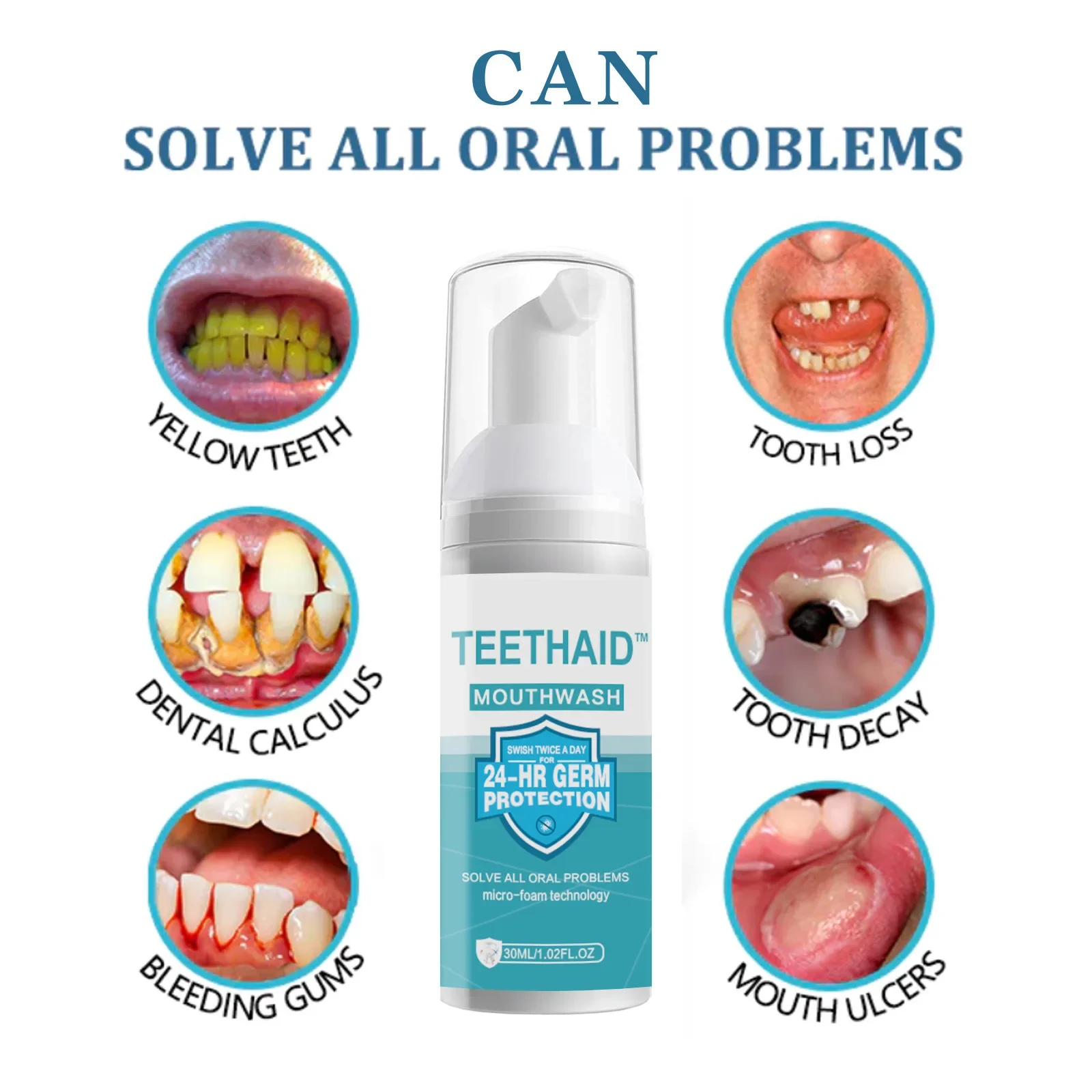 Sdottor New Tooth Cleaning Mousse Dentifricio Collutorio Alito Fresco Rimozione Delle Macchie Dei Denti Schiarente Sbiancante Sbiancante Hyg Orale