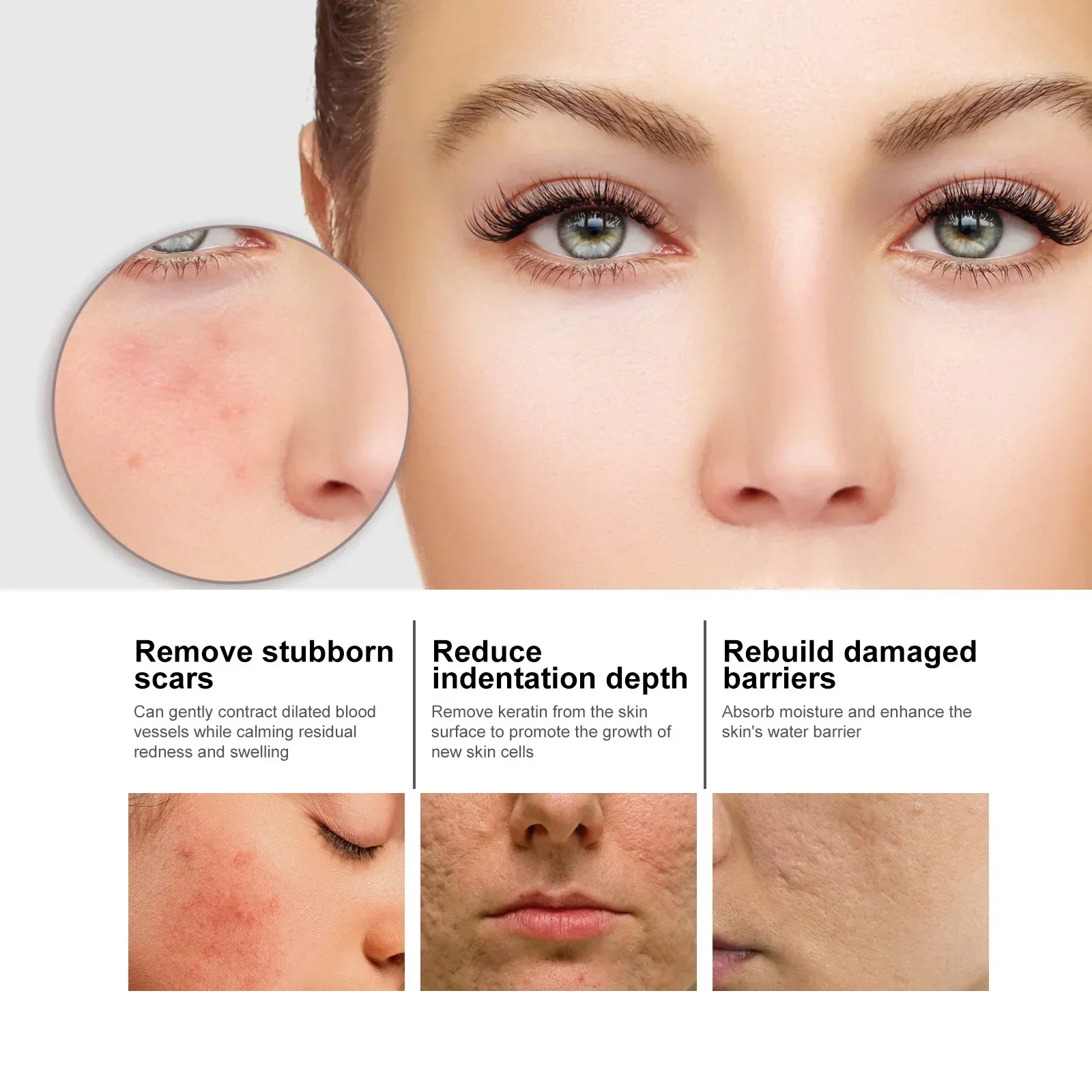 Niacinamide Serum for Acne and Dark Spots Hyaluronic Acid Anti Aging Face Serum Pore Shrinking Hydrating Moisturizing 50ml facial serum essence