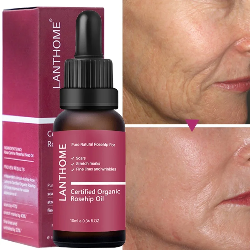 

Wrinkle Remover Face Serum Fade Fine Lines Body New Old Stretch Mark Removal Serum Acne Treatment Moisturizing Tighten Skin Care