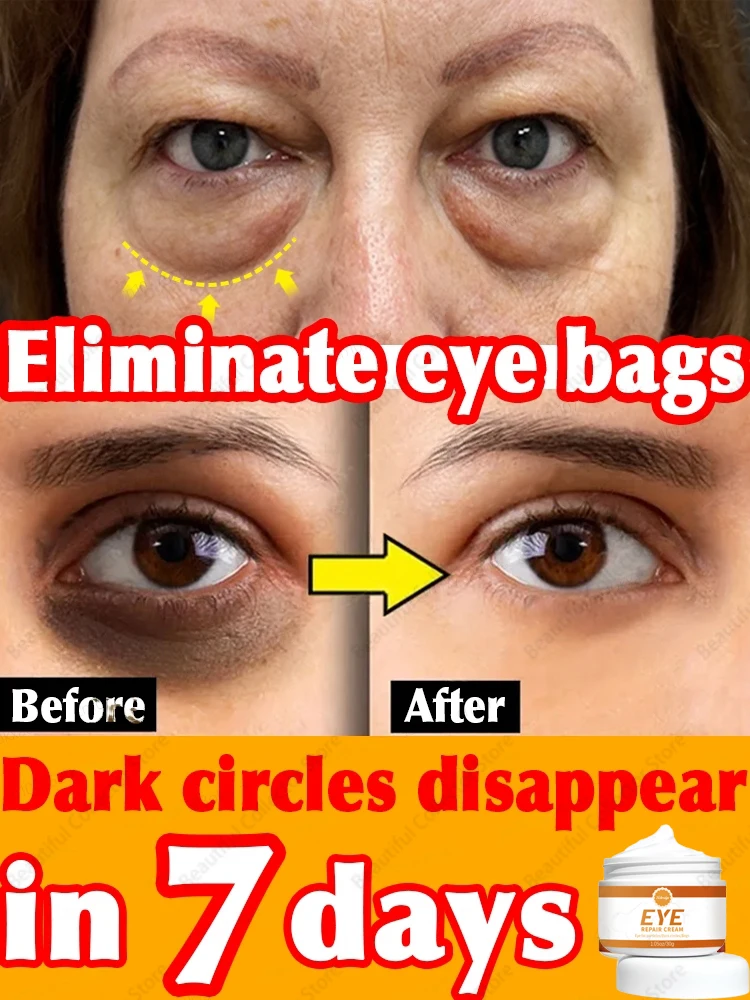 Eye Cream Eye Bags Disappear Care