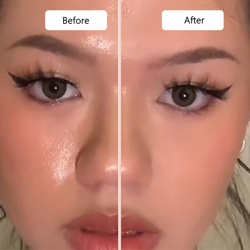 face oil absorbing roller