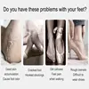 Pedicure Electric Foot Grinder Electronic Pedicure Remover Exfoliating 4