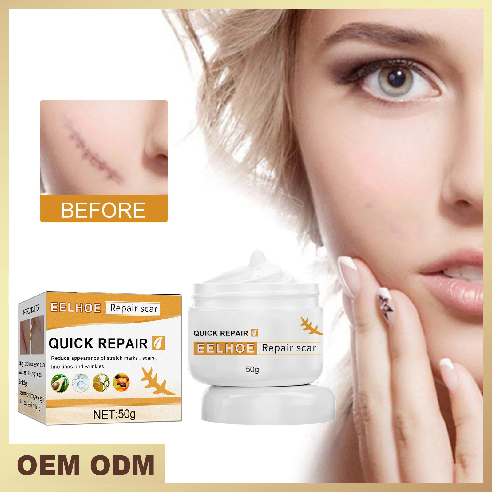 Herbal Scar Removal Cream Gel Repairing Pock Burn Treatment Surgical