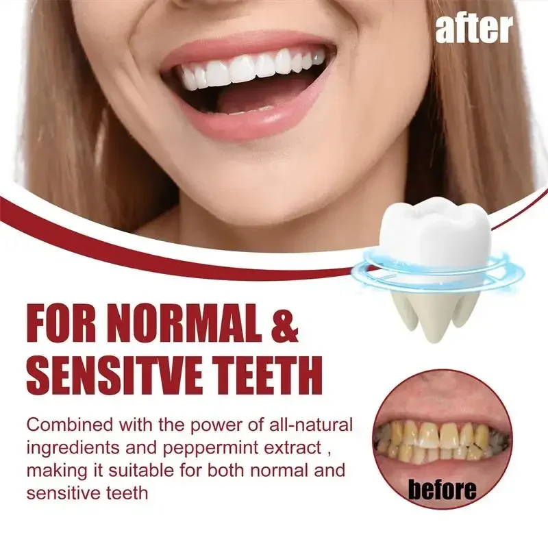 SP-10 Probiotic Toothpaste Whiten Tooth Remove Plaque Stains Teeth Whitener Oral Hygiene Clean Fresh Breath Teeth Care Product teeth whitening essence teeth whitening product teeth health product