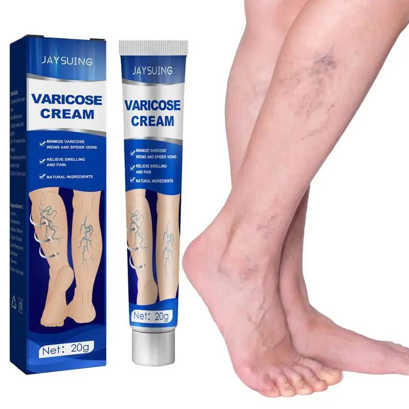 20g Varicose Vein Cream Red Blood Streak Repair Leg Raised Vasculitis