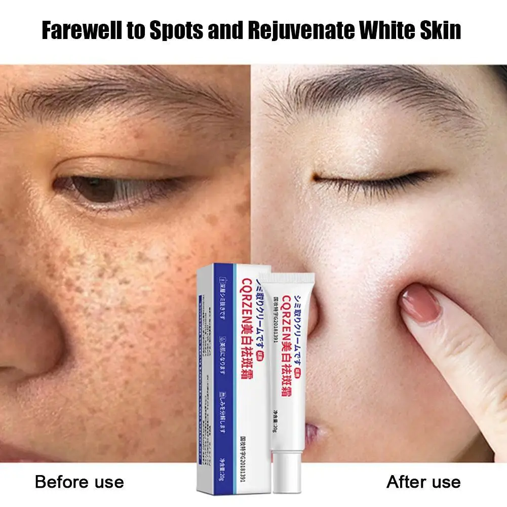 

Effective Whitening Freckle Cream Removal Dark Spot Face Corrector Repair Brighten Moisturizing Beauty Skin Care