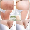 Pregnant Women's Belly Line Cream For Preventing Postpartum Pregnancy Lines Repair Cream 1
