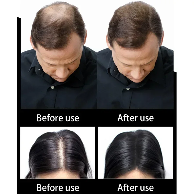 Regrowth Wig Oil Extension Hair Fibers Keratin Hair Loss Thinning Styling Powder Fiber Spray Applicator Sevich 25g Refill