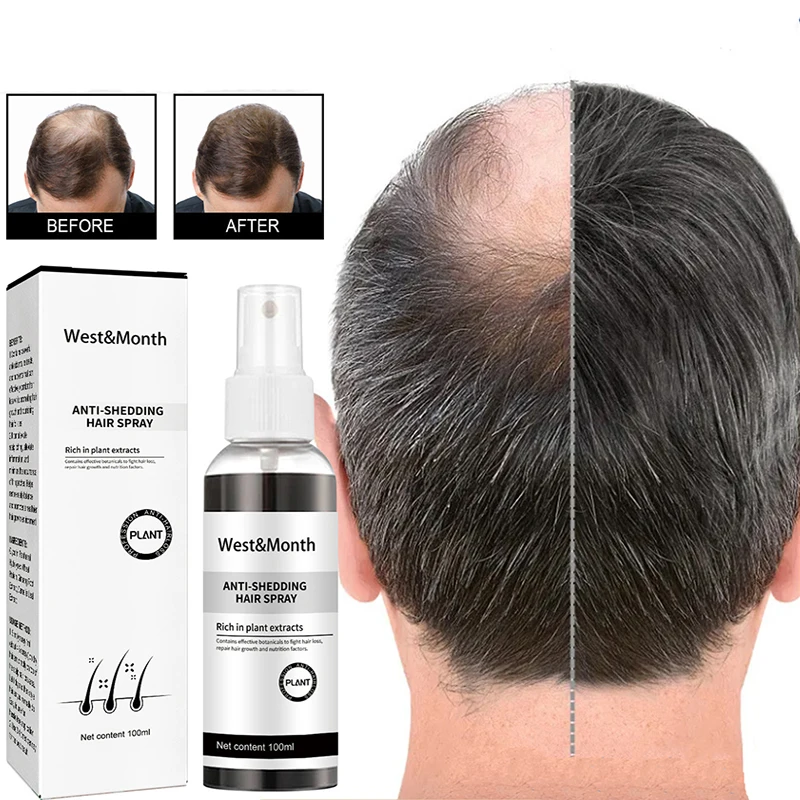 

Powerful Hair Growth Serum Spray Anti Hairs Loss Product Treatment Oil Repair Nourish Roots Regrowth For Men Women 100ml