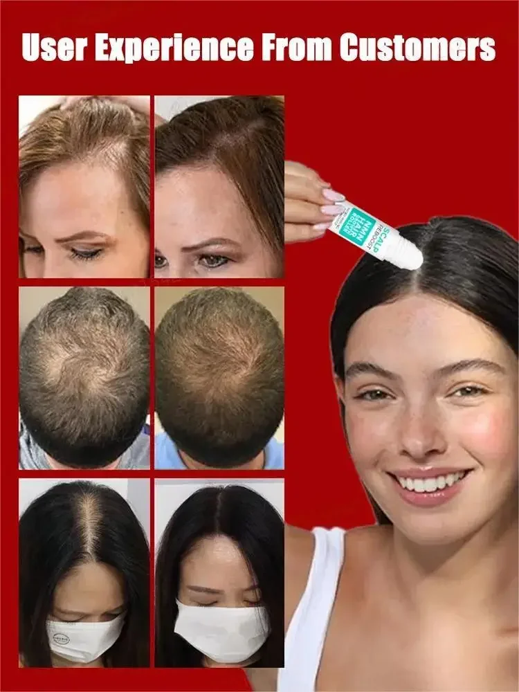 Natural Hair Growth Oil Effective Hair Growth Products For Men Women Scalp Nourishing Care Loss Solution hair growth serum