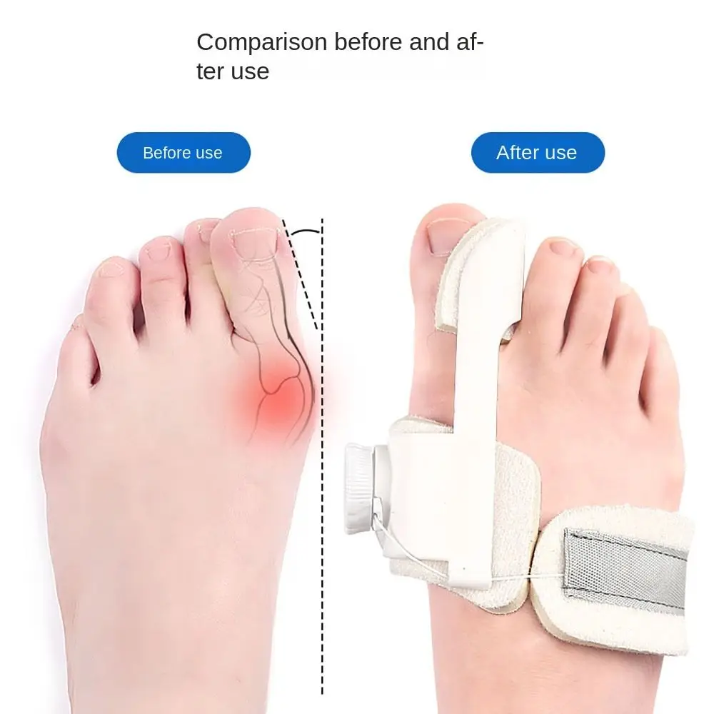 NEW Adjustable Bunion Valgus Corrector Breathable Comfortable Hallux Valgus Corrector Foot Care Tools Hallux