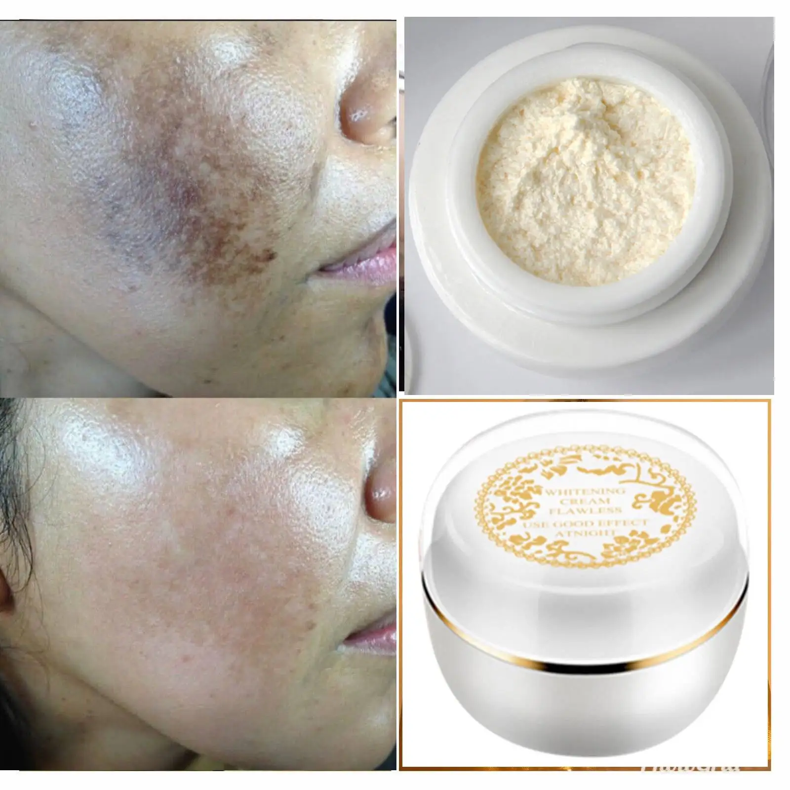 

Golden Peral Beauty Creams For Acne Wrinkles,Dark Circles 100% Original Melasma Cream Whitening Dark Spot Severe Anti-Acne