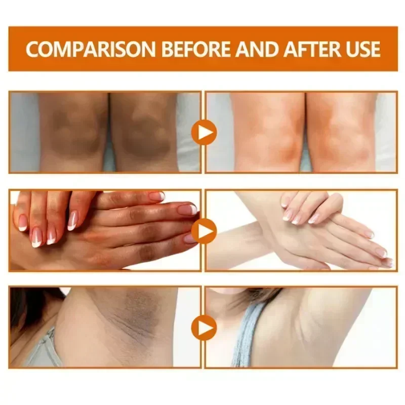 Dark knuckles whitening serum Elbows Armpit Beaching SerumWoman Private Part Skin Removal Dark Knuckles Strong Whitening Serum 6