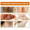 Dark knuckles whitening serum Elbows Armpit Beaching SerumWoman Private Part Skin Removal Dark Knuckles Strong Whitening Serum 6