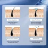 Painless Hair Removal Underarm Private Facial Body Leg Hair Remove Cream  Skin Care Powerful Beauty Hair Removal For Men Women 2
