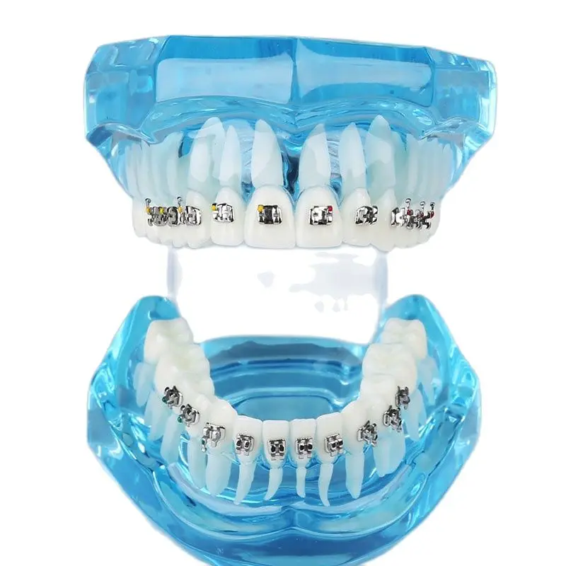 

Sales M3001 Dental Teaching Model Orthodontic Tooth Model with Metal Brackets