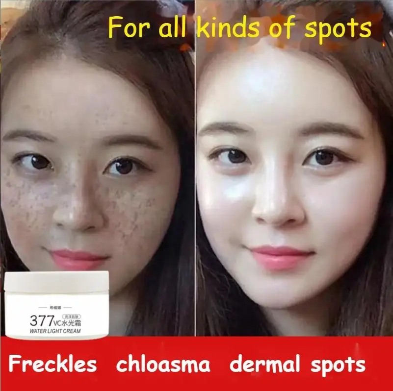 

377 whitening cream VC cream freckles chloasma senile plaques beauty salons yellowing cream control cream