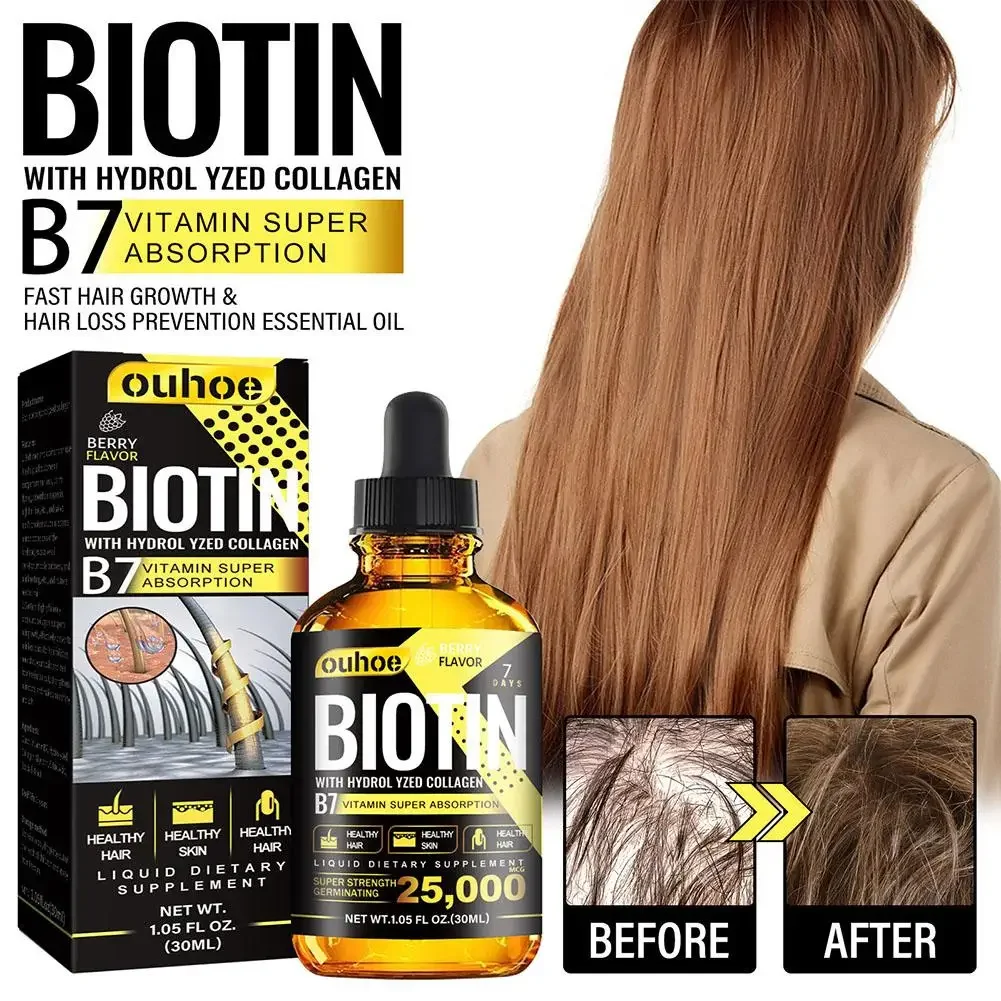 Description Picture 5 of itemProducts Biotin Fast Growing Hair Care Essential Oils Anti Hair Loss Spray Scalp Treatment For Men Women 30ml