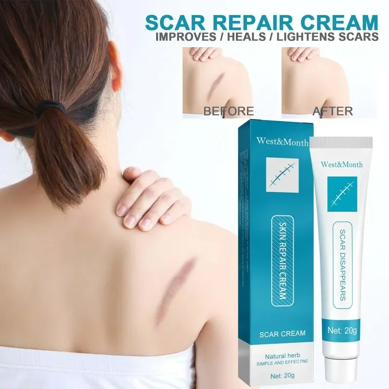 

Scar Removal Cream Gel Repairing Pock Mark scald Burn Surgical Scar Cesarean Scar Stretch Marks Smooth Moisturizing Skin Care