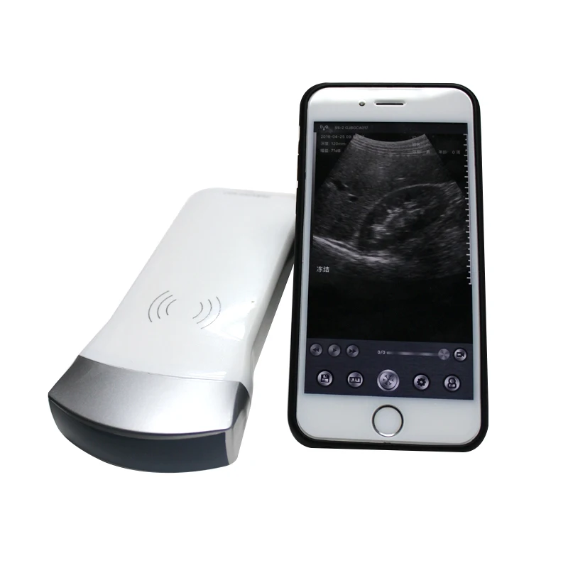 

3 in 1 Portable wireless ultrasound probe smartphone wifi linear Handheld doppler for medical