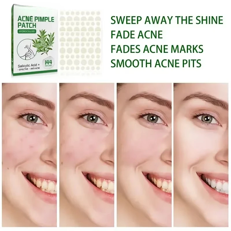 144pcs Acne Pimple Patch Face Invisible Stickers Quick Effect Treatment Removing Patches Beauty Acne Tools Face Skin Care